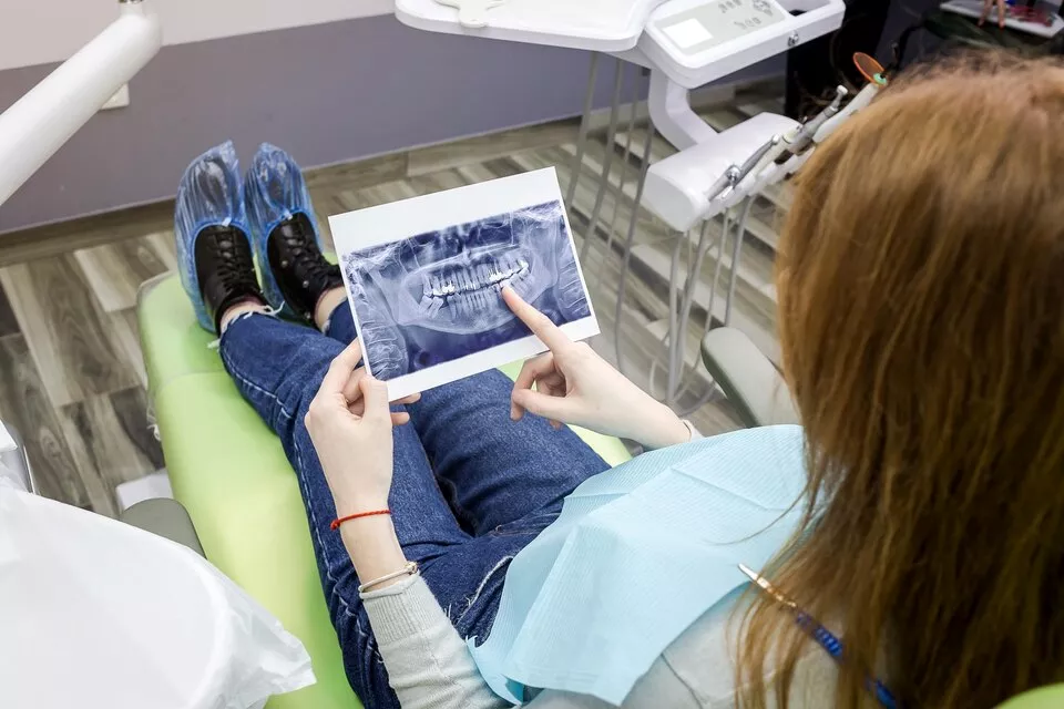 X-RAY OPG